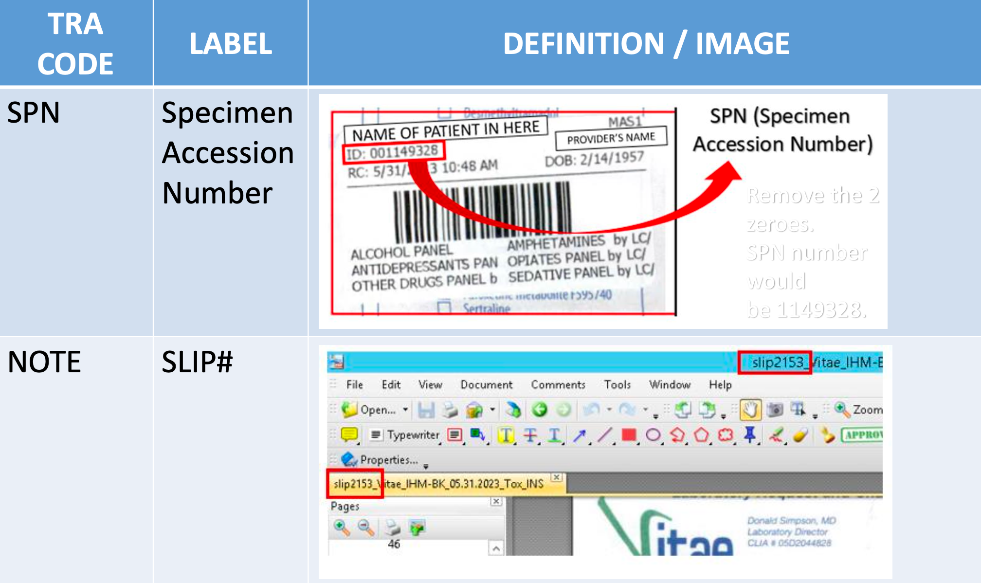 C4s1 procedure codes and other tra's for charge en