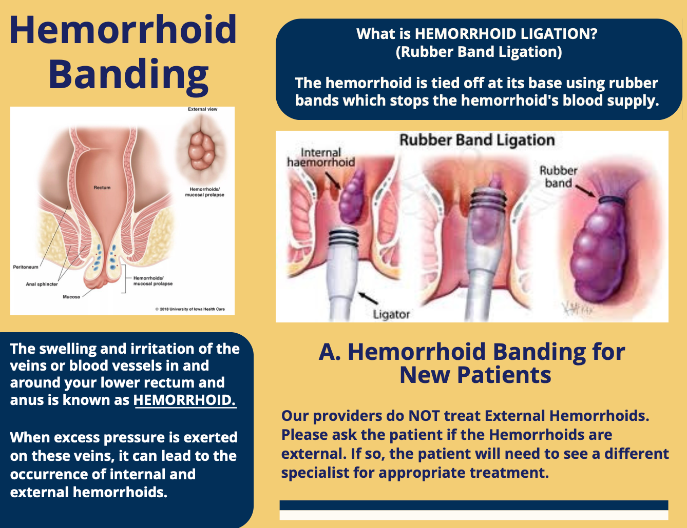 Banding