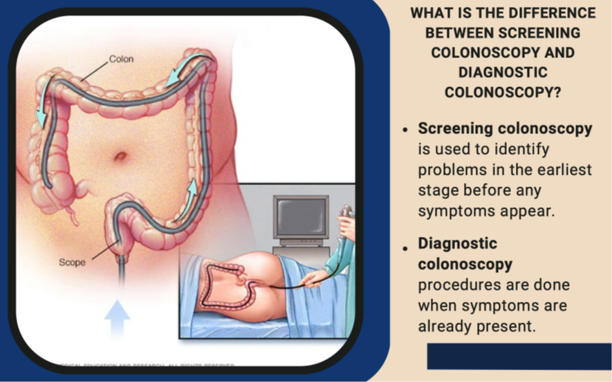 Center procedures colonoscopy