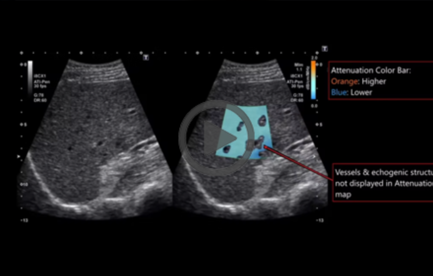 Mri   acquisition is faulty (9)   situation expert 2025 02 12 09 47 08